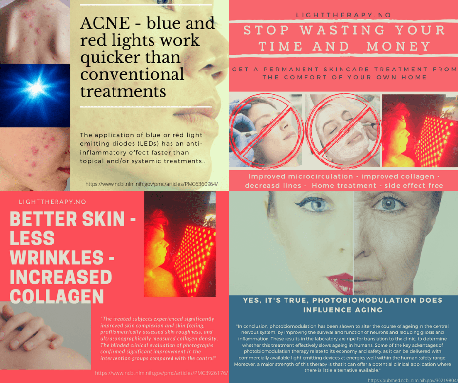 Rødlysterapi-panel brukt på arrvev og sårheling hjemme i Norge fra LightTherapy.no
