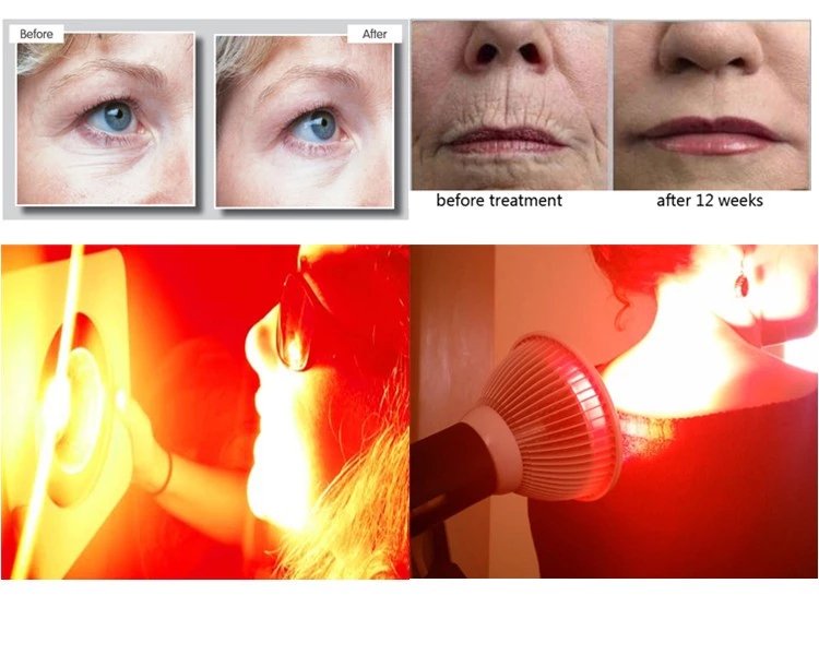 Why Red and Infrered light is the perfect skin treatment - Home Light Therapy