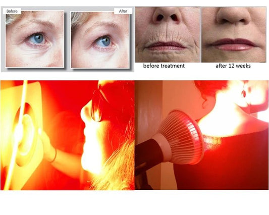 Why Red and Infrered light is the perfect skin treatment - Home Light Therapy