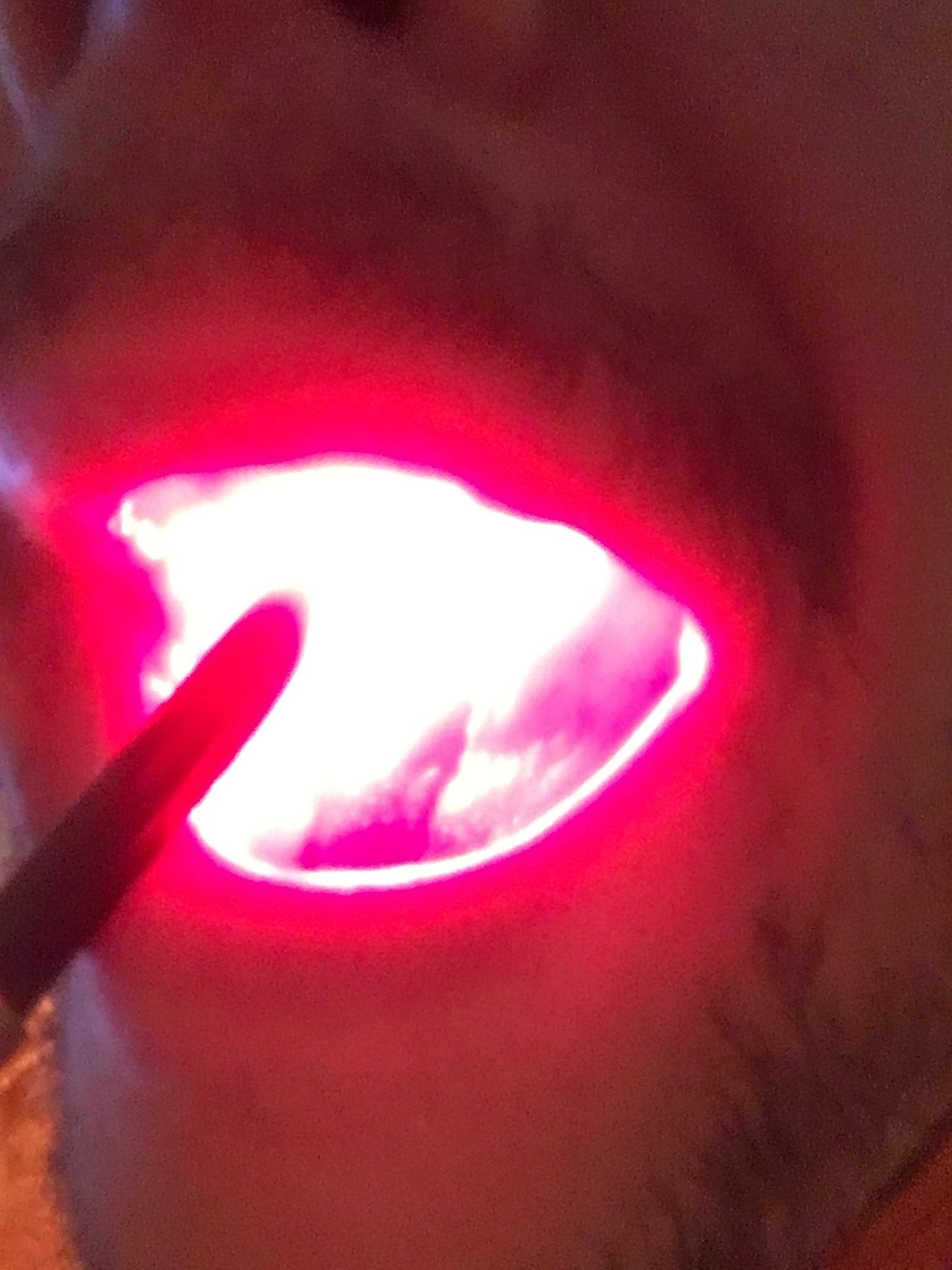 High Power Red Light Therapy Torch — Photopuncture & Deep Tissue - Home Light Therapy