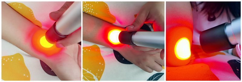 High Power Red Light Therapy Torch — Photopuncture & Deep Tissue - Home Light Therapy